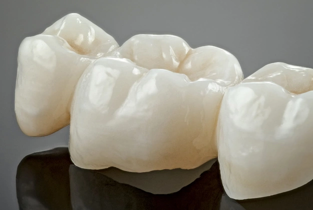 dental crowns in camarillo