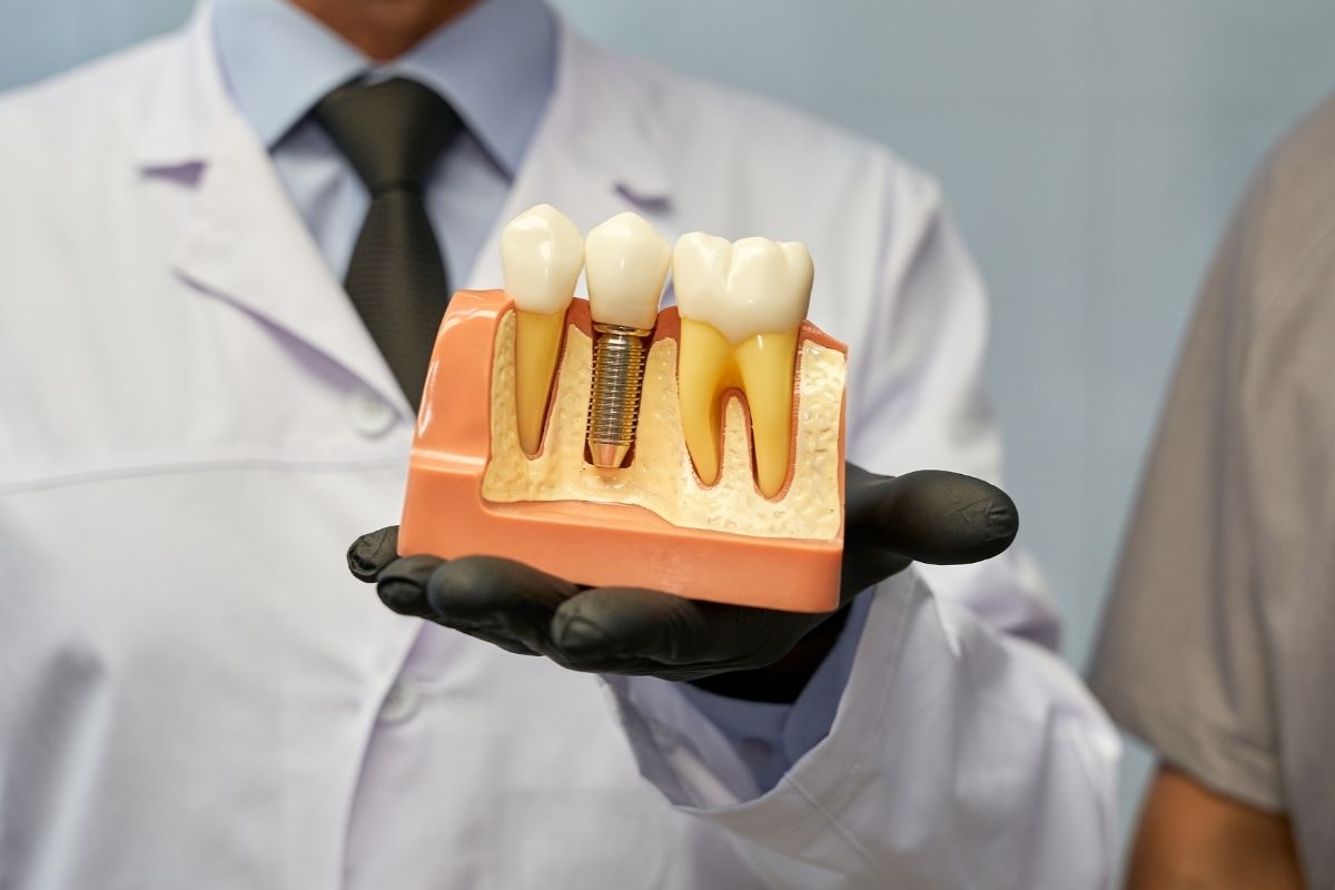 What Are the Steps to Getting Dental Implants?