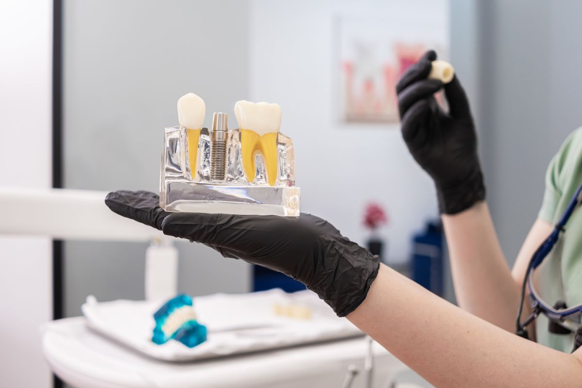 How Long Do Dental Implants Last with Proper Care